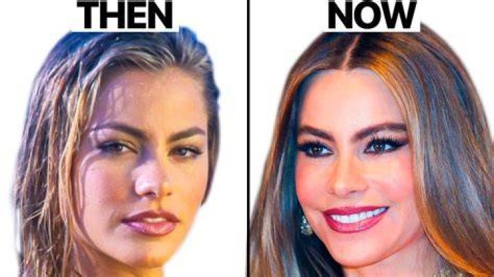 
Sofia Vergara’s Loss Journey And Reasons With Her Before And After Photos 